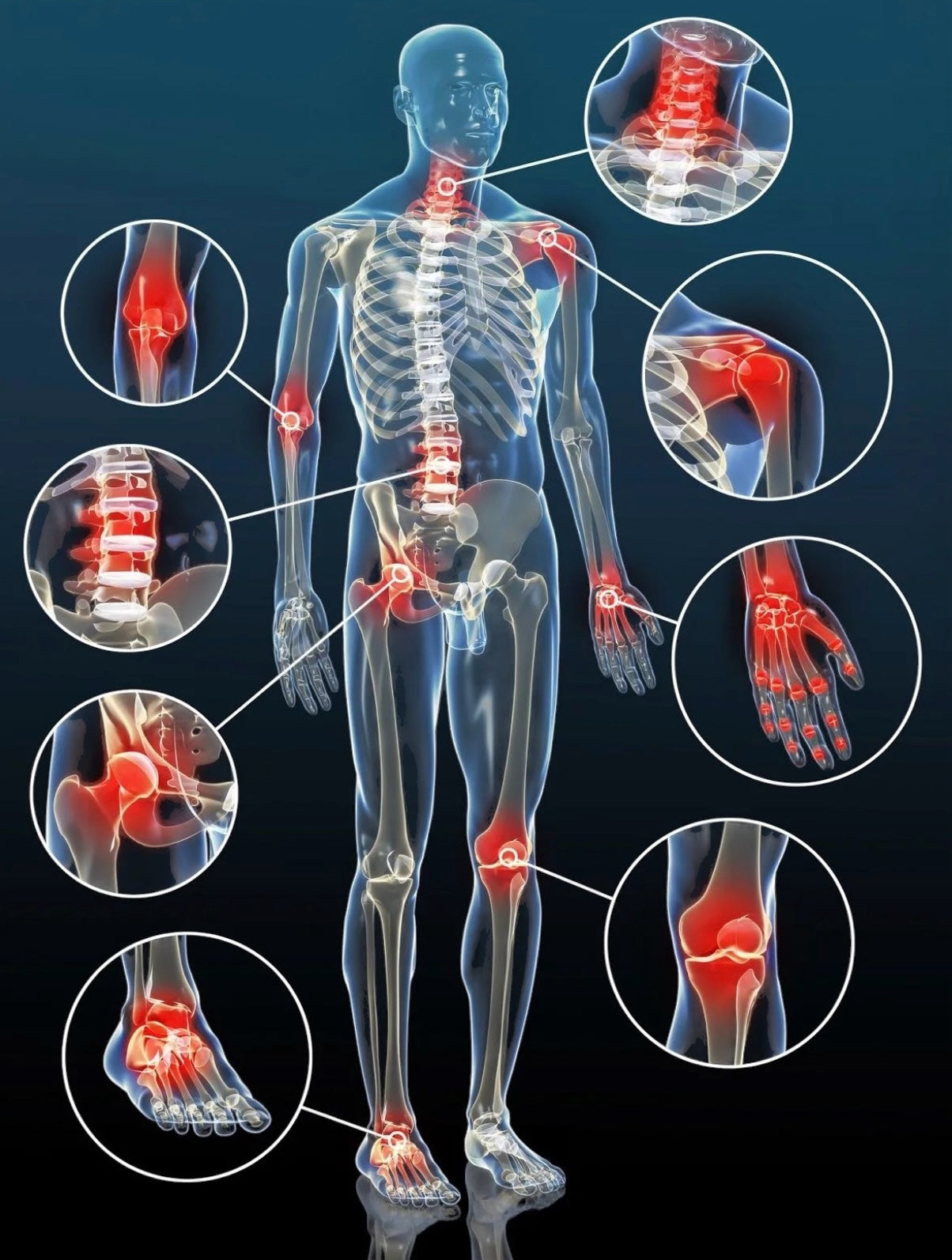 CLM015R Magnetic Bracelet Linked 5 elements 210X9MM